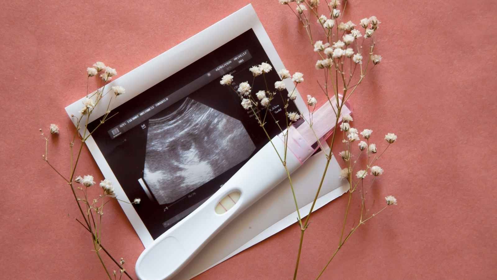 Is Pregnancy a Career Setback?
